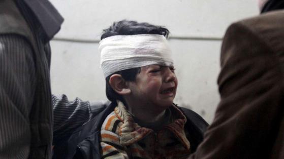Ein kleiner Junge wird in einem Krankenhaus versorgt, nachdem er bei Luftschlägen des Diktators Baschar al-Assad verletzt worden ist (Damaskus, Dezember 2014)