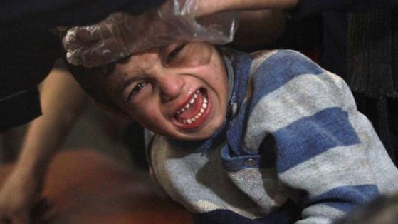 Ein verwundeter Junge wird nach einem Luftschlag der syrischen Regierungstruppen auf den Stadtteil Duma in Damaskus verarztet (Dezember 2014)
